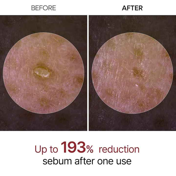 HerGlowelle Rice Peel Shot Serum™